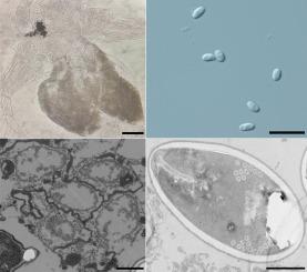 Neoflabelliforma diaphanosoma n. sp. (Microsporidia) from hypoderm of diaphanosoma leuchtenbergianum (Crustacea: Sididae) in China