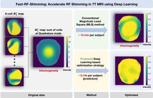 Fast-RF-Shimming: Accelerate RF shimming in 7T MRI using deep learning
