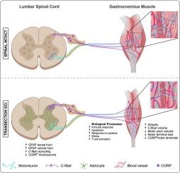 CGRP+ fibers sprout within gastrocnemius muscle following complete spinal cord injury in rodents