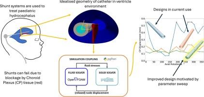 Reduced model aided fluid-structure interaction design framework for shunt systems