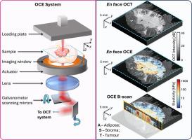 Imaging the microscale mechanical properties of cancer using optical coherence elastography