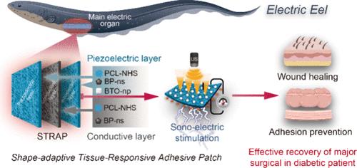 Electric Eel-Inspired Bioelectromechanical Bandage with Biochemical-Photothermal-Piezoelectric Synergy for Promoting Postoperative Recovery in Diabetes