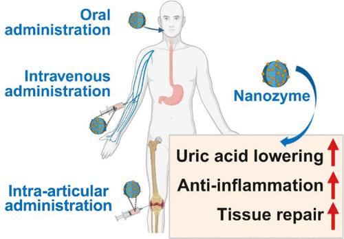 Nanozyme-Based Therapy in Gout
