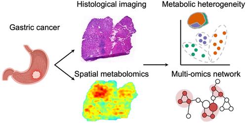 Key Lipid Reprogramming Revealed in Gastric Signet Ring Cell Carcinoma by Spatial Mass Spectrometry Metabolomics