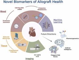 Molecular diagnostics for the monitoring of the cardiac allograft