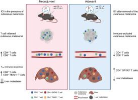 Neoadjuvant immune checkpoint inhibition improves protection against hepatic melanoma metastasis