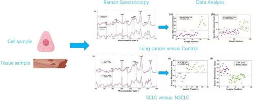 Precise diagnosis of small cell and non-small cell lung cancer based on Raman spectroscopy