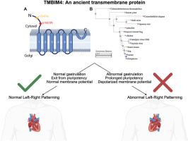 TMBIM4 affects left-right patterning via pluripotency exit during gastrulation