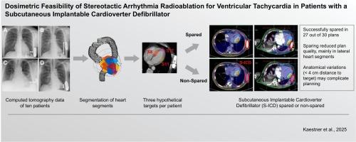 Dosimetric feasibility of stereotactic arrhythmia radioablation for ventricular tachycardia in patients with a subcutaneous implantable cardioverter defibrillator