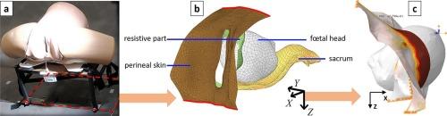 Reliability and educational potential of a computational model of vacuum-assisted delivery on a birth simulator