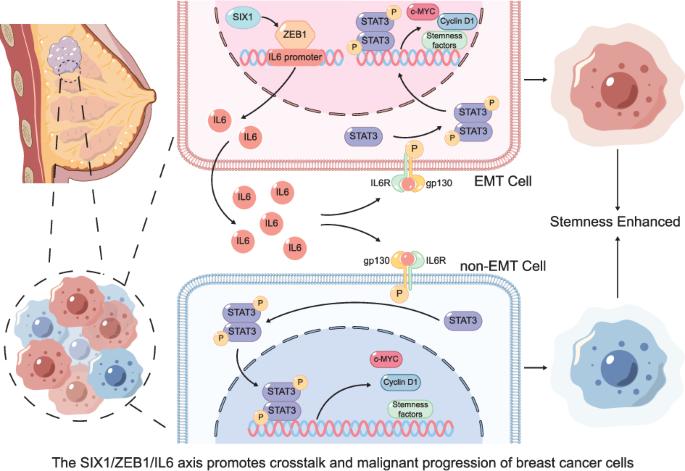 SIX1 transmits signals for breast cancer progression via the ZEB1/IL6/STAT3 signaling axis