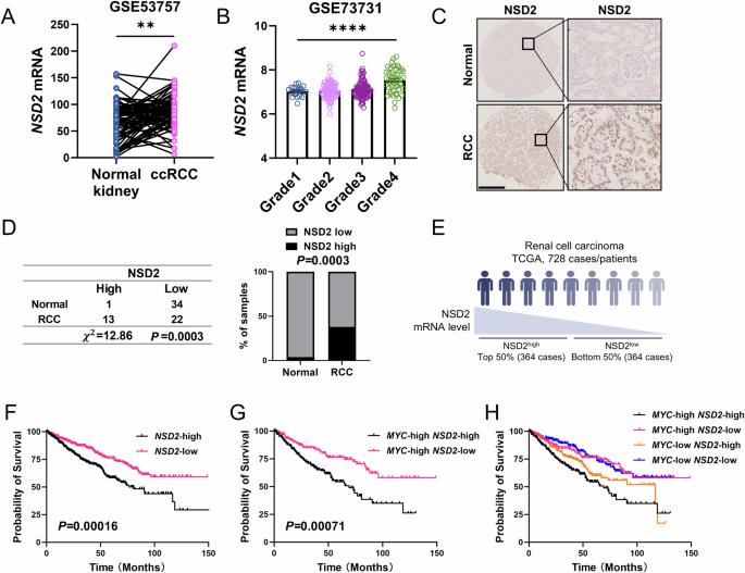 NSD2 promotes cell durotaxis and drives the transition from polycystic kidney disease to tubulocystic renal cell carcinoma through integrin/FAK/AKT signaling