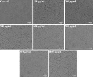 Synthesis and Characterization of Water-Soluble Polypyrrole-Sulfonated Naphthalene Formaldehyde Composite as a Selective Turn-off Chemosensor for Pb2+, Antimicrobial Activity, and Molecular Docking Studies