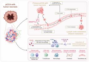 Tumor necrosis facilitates perihilar cholangiocarcinoma metastasis by ANGPTL6-augmented vessel permeability and tumor dissemination