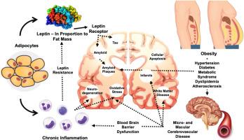 Fat, fib, and forgetfulness: The interplay between adiposity, atrial fibrillation, and dementia