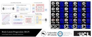 Brain Latent Progression: Individual-based spatiotemporal disease progression on 3D Brain MRIs via latent diffusion