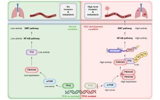 Elevated FBXO45 promotes TFG ubiquitination and drives lung metastasis of hepatocellular carcinoma