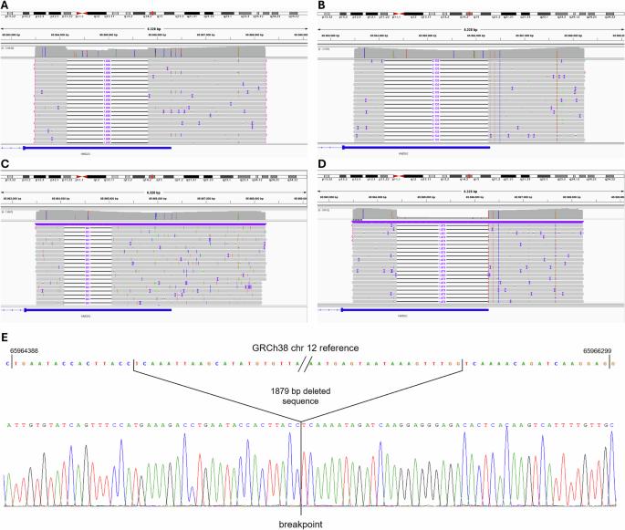 A novel approach for highly sensitive and rapid identification of HMGA2 submicroscopic deletions in myeloproliferative neoplasms