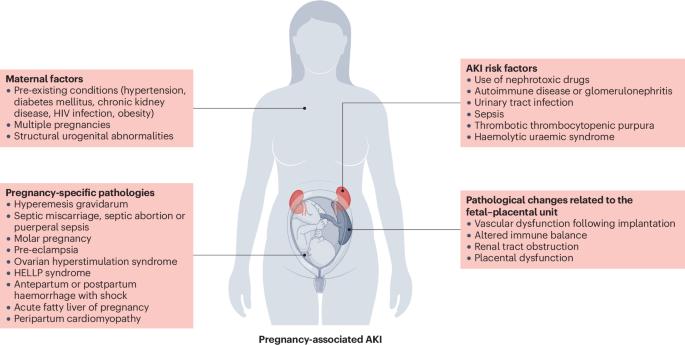 Pregnancy-associated acute kidney injury — consensus report of the 32nd Acute Disease Quality Initiative workgroup