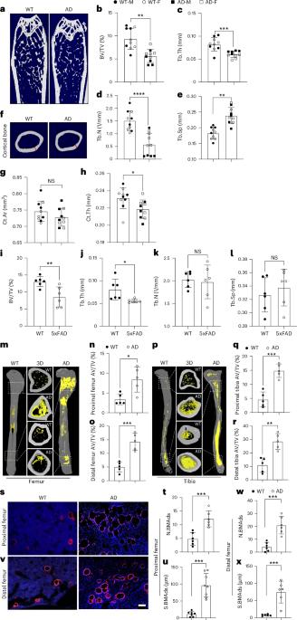 Serum amyloid P secreted by bone marrow adipocytes drives skeletal amyloidosis