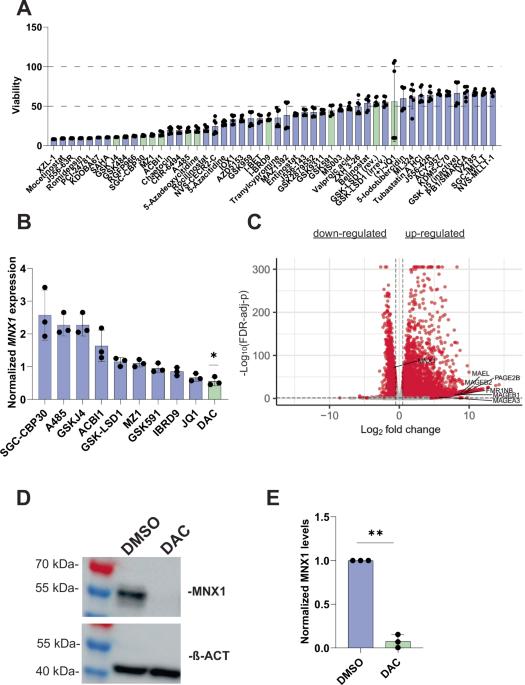 DNA demethylation-mediated downregulation of MNX1 in acute myeloid leukemia