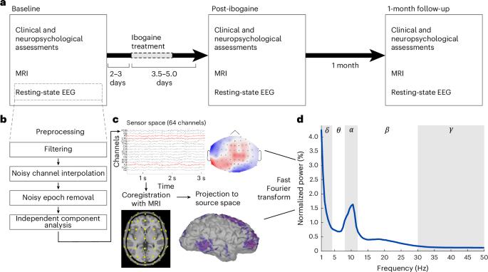 Magnesium–ibogaine therapy effects on cortical oscillations and neural complexity in veterans with traumatic brain injury