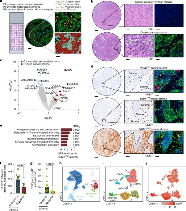 NNMT inhibition in cancer-associated fibroblasts restores antitumour immunity