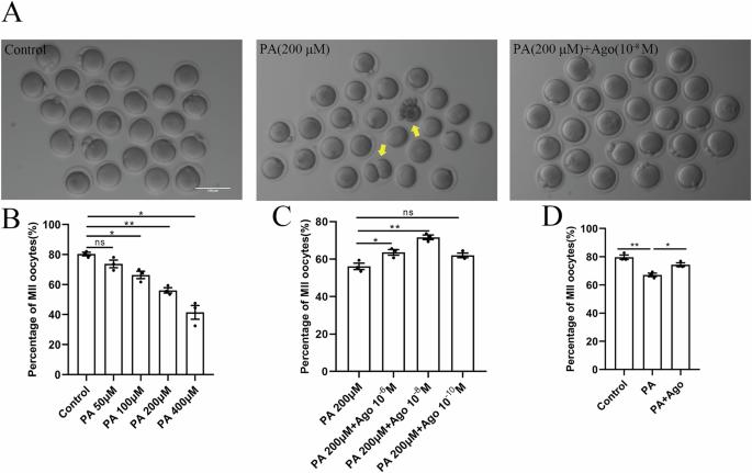 Agomelatine alleviates palmitic acid-induced mouse oocyte meiosis defects by restoring mitochondrial function