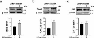 CAD (Cath. a-Differentiated) Cells Produce Dopamine along with Dopamine-Synthesizing Enzymes