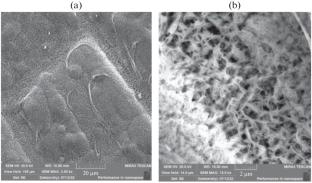 Anti-Corrosion Layered Coatings Based on Electrochemical Zinc–Nickel Alloy