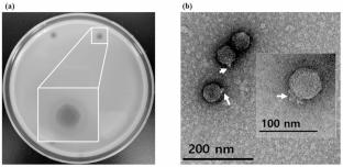 Genome sequencing of Pasteurella multocida phage PMP1 elucidates a possible host resistance mechanism and suggests that it belongs to a new species