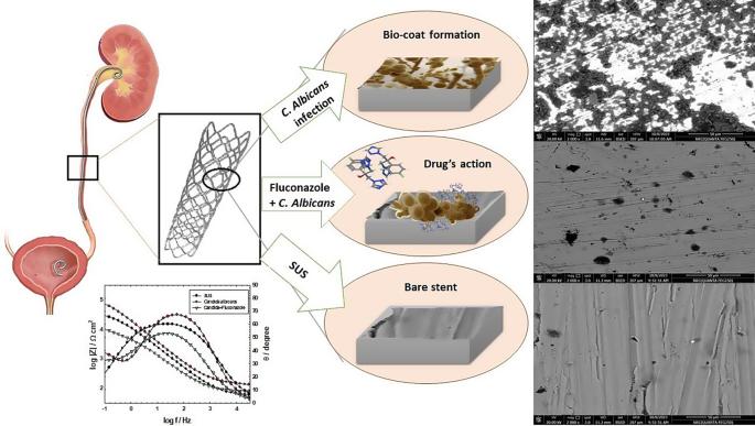 Electrochemical evaluation of stainless steel alloy as a ureteral stent in synthetic urine solution in-vitro with Candida urinary tract infection