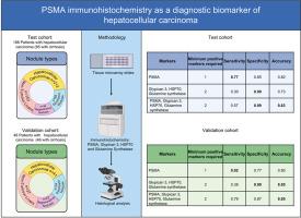 PSMA immunohistochemistry as a diagnostic biomarker of hepatocellular carcinoma