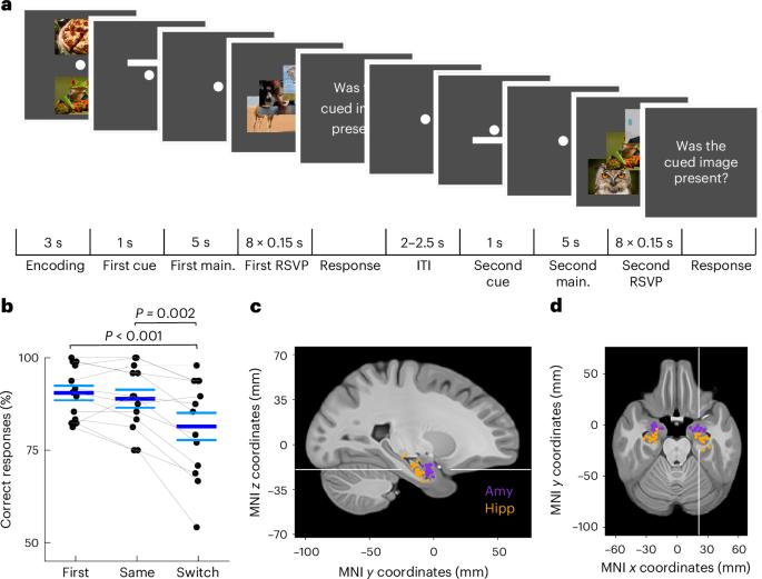Unattended working memory items are coded by persistent activity in human medial temporal lobe neurons