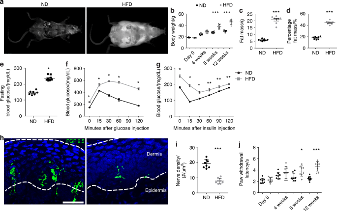 Reduced somatosensory innervation alters the skeletal transcriptome at a single cell level in a mouse model of type 2 diabetes.