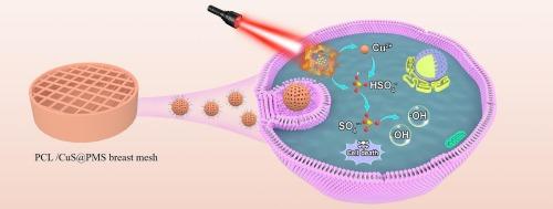 Stimuli-responsive CuS@PMS nanosystem boosts O2-independent antitumor activities of meshes