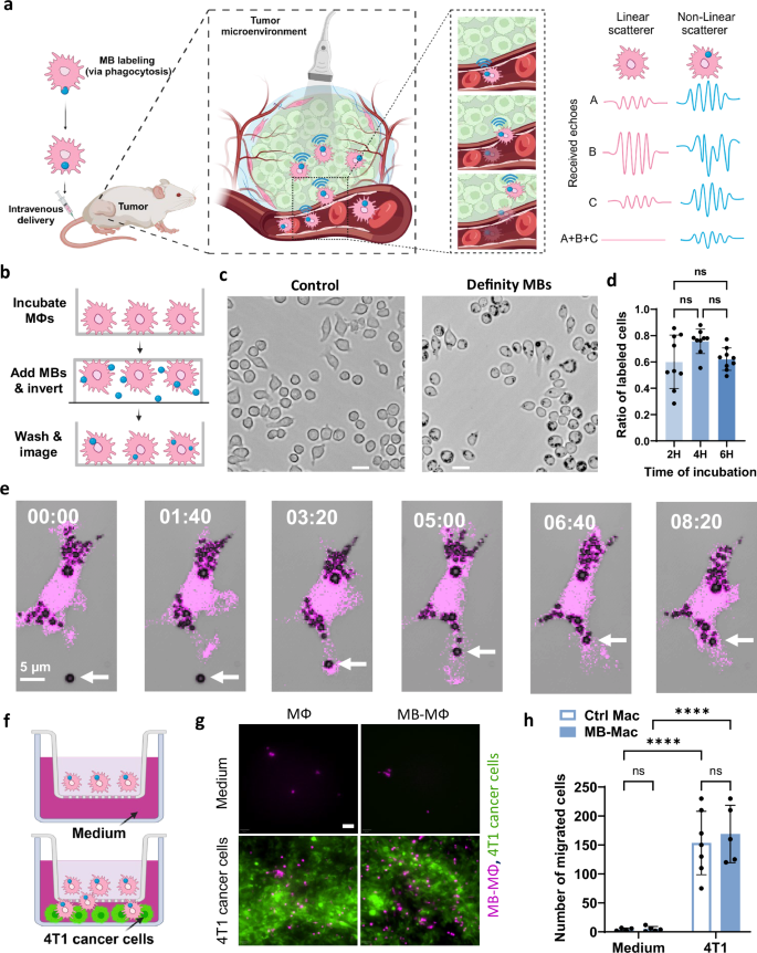 Imaging of macrophage accumulation in solid tumors with ultrasound
