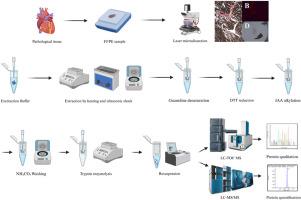 Development of a novel targeted LC-MS/MS methods for the typing of cardiac amyloidosis