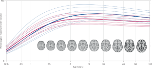 Artificial intelligence advances skull stripping across lifespan