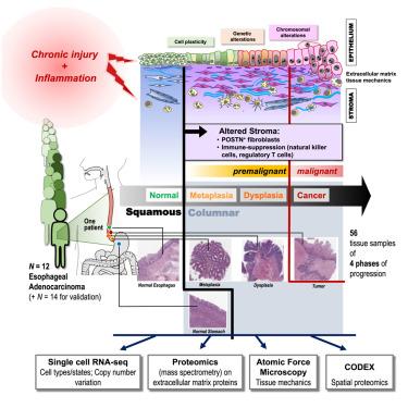 Concerted changes in Epithelium and Stroma: a multi-scale, multi-omics analysis of progression from Barrett’s Esophagus to adenocarcinoma