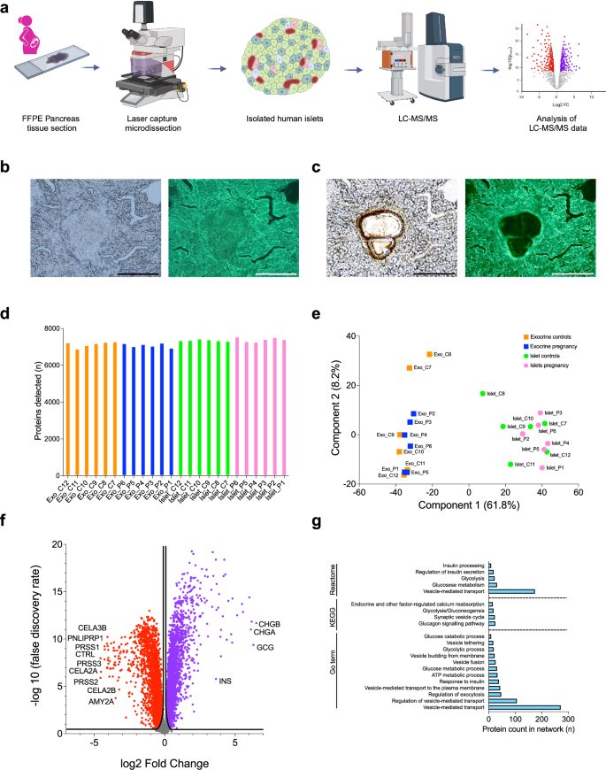 A new paradigm of islet adaptations in human pregnancy: insights from immunohistochemistry and proteomics