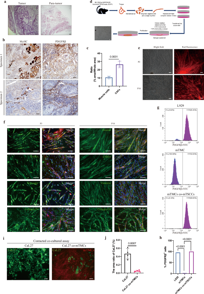 Transdifferentiation of tongue muscle cells into cancer-associated fibroblasts in response to tongue squamous cell carcinoma
