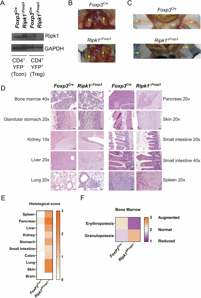 Ripk1 is critical for preserving effector regulatory T cells and the suppressive transcriptional program in regulatory T cells