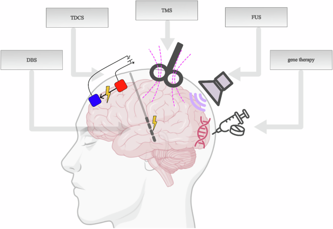 Advancements in invasive and non-invasive neuromodulation for Parkinson’s disease: current findings and future directions