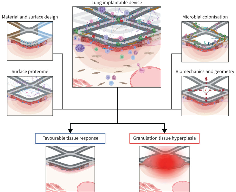 Lung implantable devices: the issue with granulation tissue.