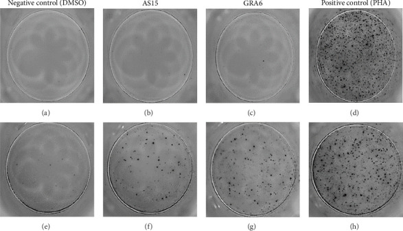 Study on the T-Cell Immune Response in Individuals With HIV and Toxoplasmosis Using ELISPOT.