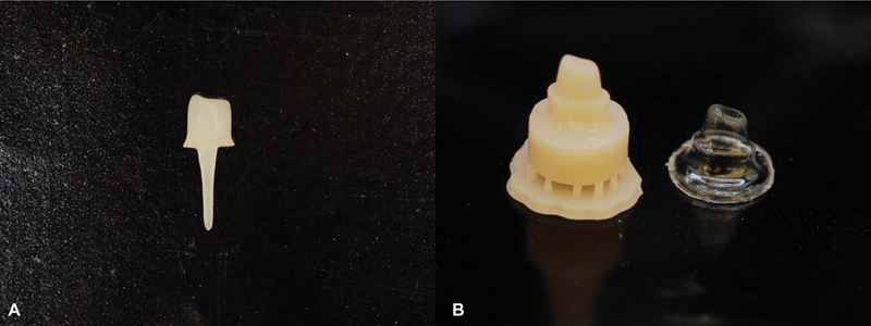 Fracture Resistance of Resin Matrix Ceramic Post and Core Compared to Prefabricated Fiber-Reinforced Composite Post and Core in Non-Ferrule Effect Teeth: An In Vitro Study.