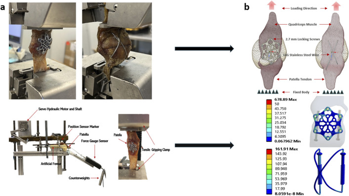 Finite Element Analysis of Patellofemoral Contact Pressure with Varying Fixation of Transverse Patella Fractures.