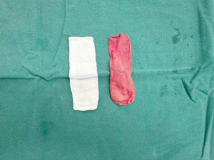 Application of indocyanine green fluorescence angiography in laparoscopic sleeve gastrectomy: preliminary results.
