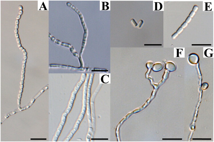 <i>Arthrographis abieticola</i> sp. nov., A Novel Soil-Derived Fungal Species from Korea.